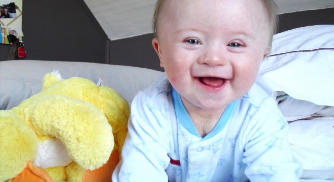 What doctors should tell you about having a baby with Down syndrome
